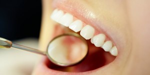 Close-up of open mouth during oral checkup at the dentists