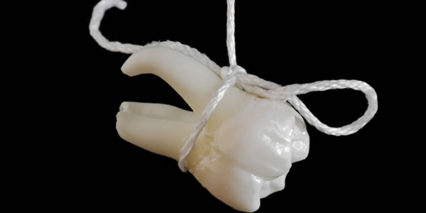 extracted tooth